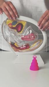 INTIMINA Lily Cup Compact Size A (Beginners/Cesarean Delivery with Low to Average Cervix)