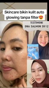 DNA Salmon SR12 Skincare - Paket Perawatan Wajah Premium Pencerah & Perlindungan SPF untuk Semua Jenis Kulit