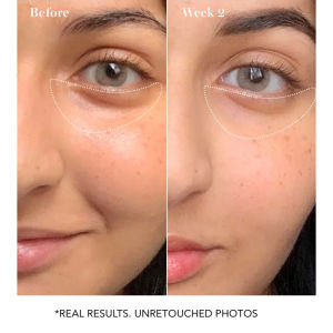 Retinol Night Moisturiser Cream Rapid Wrinkle Repair Retinol Eye Cream Anti-blue light oxidation Stay up late eye cream 30g Eye Essence fat Granule Removal Fading Fine Lines Anti-dark Circles Anti-wrinkle Anti-aging Remove Eye Bags Particles