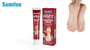 Sumifun foot cream cracked heel remover hand cream for dry hands Foot cream for Cracked heels callus removal for foot pair with callus remover foot grinder callus cream remover Foot Care Cream 20g