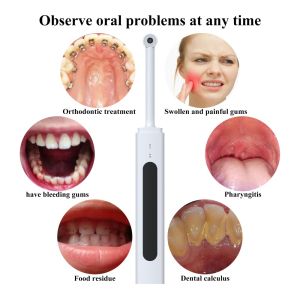 VV DENTAL | Dentistry Camera Wifi Oral Endoscope With 8Pcs Led Lamps 300W Pixel Oral Examination Diagnostic Tool