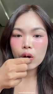 The Awesome Patch –แผ่นลิปฟิลเลอร์แบบแปะ ไมโครนีดเดิล 800 เข็ม |By Moonshot Labs (Moonshot Skincare) |ช่วยให้ปากอวบอิ่ม