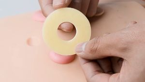4mm Ostomy Paste Ring Ostomy Barrier Ring Stoma Leakproof Ring For Protect Skin