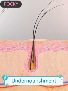 penumbuh rambut shampoo anti rontok shampo rambut rontok 300g Shampoo Penyeimbang Minyak Anti Ketombe & Nutrisi Kulit Kepala