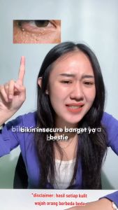 Serum AHA BHA Leika Skincare: Solusi Jerawat, Bruntusan & Kulit Sensitif