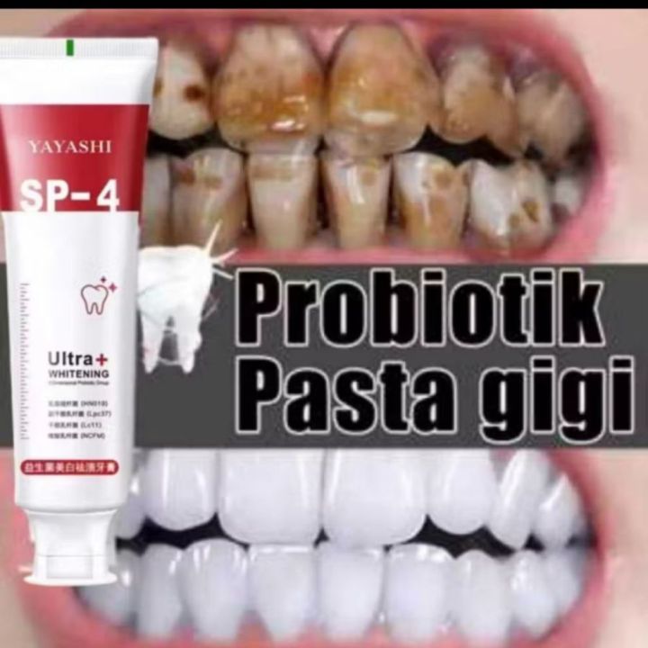 Whitening Toothpaste pasta gigi probiotik SP-4 gigi putih pasta gigi