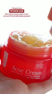 SR12 Acne Cream - Serum Penyembuh Jerawat dengan Vitamin C & Formula Perawatan Kulit Berminyak untuk Pencerahan Wajah