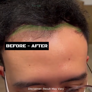 hair growth serum  VERBLE new pack 2025 /  VERBLE Serum tonik lebatkan rambut