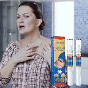 [HCM]TAG&WART REMOVER Tẩy nốt ruồi xóa mụn ruồi trên mặt tàn nhang mụn cóc mụn thịt mụn cơm mắt cá tại nhà an toàn và gel mờ sẹo Kem ngăn sẹo kem ngừa sẹo lồi thâm sẹo rỗ lâu năm các loại sẹo mụn.TRÂU REMOVE