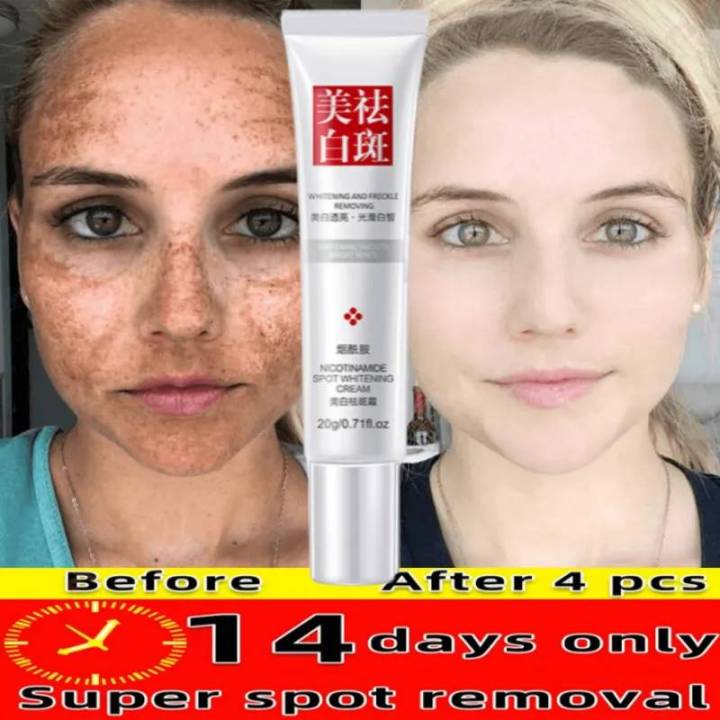 Whitening Cream Fades Freckle Dark Spots Face Cream Niacinamide Whiten ...