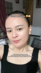 KYMM SKIN Red Peeling Whitening Serum with 10% AHA BHA PHA Kojic Acid 50ml