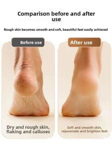 JIFANPAUL | Electric Foot File for Home Use - Powerful Dead Skin and Callus Remover