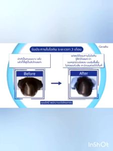 วิตามินผม ไบโอติน เอช พลัส Biotin H Plus ลดผมขาดหลุดร่วง เพิ่มผมงอกใหม่ ผมแข็งแรงสุขภาพดี 30 แคปซูล