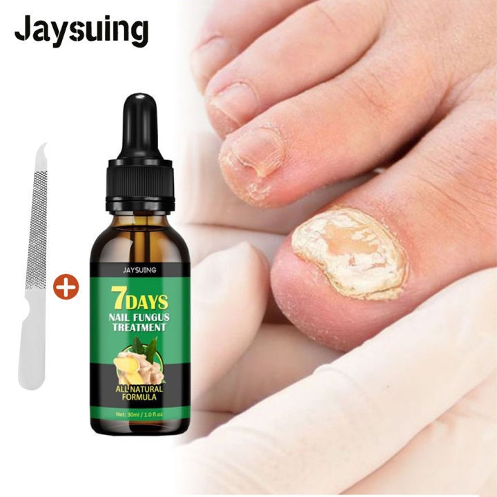 lanthome Nail Repair Essence Serum Fungal Nail Treatment Anti Fungal