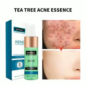 HEMEIEL Tea Tree Acne Remover Acne Treatment Serum Anti Acne Scar Removal Cream Whitening Repair15ml