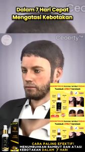 VAELA Hair Serum Melebatkan Rambut Mengatasi Rambut Botak Memperkuat Akar Rambut Kurangi Kerontokan