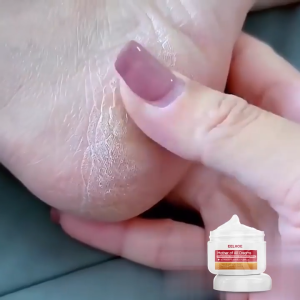 EELHOE Hand and Foot Moisturizer 30g - Itch Relief Moisturizing Cream Skin Care Soothing Cream for Cracked Skin