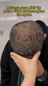 Nippori Selenium Disulfide Shampoo Oil Control Anti-Dandruff Anti-Itch Clear Malassezia Pengendalian Minyak Anti Ketombe Anti Gatal