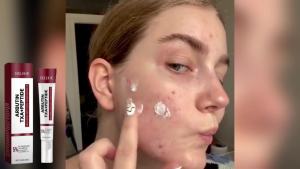 EELHOE | EELHOE Nicotinamide Face Cream Brighten Dark Skin Reduce Dark Spots Moisturizer Lightening Melanin Hydrating Skin Care Products