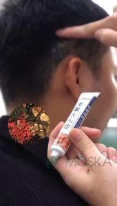 Kem Bôi Giảm Viêm Nang Lông Mụn Da Đầu Tiêu Nấm Ngứa Da Đầu Bong Tróc Vảy Bết Tóc Giảm Tiết Dầu Thừa Cải Thiện Gàu Ngứa Phục Hồi Nang Tóc Giúp Nang Tóc Chắc Khỏe Da Đầu Sạch Khoẻ Kích Mọc Tóc Dày Dài Nhanh Chóng Tóc Chắc Khỏe IWAI 20g | Moska