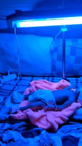 Đèn Chiếu Vàng Da Cho Trẻ Sơ Sinh TNC