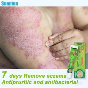 Effective Sumifun Eczema Treatment Cream: A Natural & Effective Solution for Skin Issues