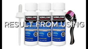 5% Minoxidil hair grower original hair growth serum fast hair growth serum