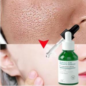 Salicylic acid Serum pengecil pori pori Serum pemutih 30ML pori bersih/kelembapan