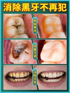 Kem Đánh Răng YueT Loại Bỏ Vết Đen Sâu Răng Chăm Sóc Răng Miệng Cho Người Lớn Làm Trắng Răng Chống Vi Khuẩn Làm Sạch Khe Hở Giữa Răng