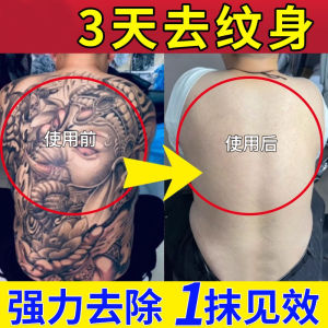 Painless Tattoo Removal Tool No Scars Quick Tattoo Fade Agent Remove Non-Medical Ointment Universal Tattoo Removal
