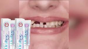 Keo Dán Răng Giả Nhiệt Dẻo Chất Làm Mềm Răng Giả Bền Lâu Keo Dán Răng Dùng Hàng Ngày Chất Giữ Răng Giả Cho Cả Nam Và Nữ Người Lớn