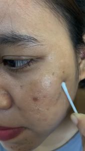 BPOM CINDYNAL Skin Cream Removal / Krim Wajah Glowing Anti Remove