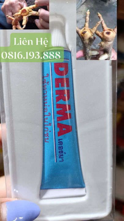 Derma - T huốc t rị lậu đế , ké chậu Thái Lan ️ Chuyên t rị lậu đế ...