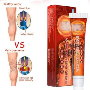 Combo 10 tuýt kem bôi suy giãn tĩnh mạch nội địa Trung Hoa