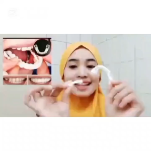 COD 1 SET ATAS BAWAH Snap On Smile Original Gigi Palsu kuat Tahan Lama