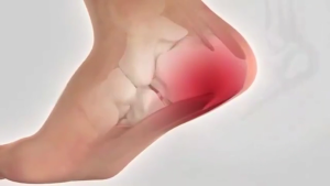 Heel pain patch Foot Pain Relief Patch Pain Relieving Plaster 10pcs Heel Spur Pain Relief Plantar Fascia and Heel Tendonitis Special Effect Paste