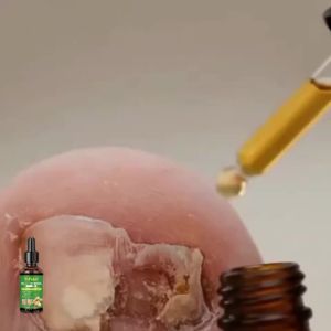 7 Days Fungal Nail Treatment Serum Anti Infection Remove Gray Toenails Repair Damage Paronychia Onychomycosis Foot Health Care