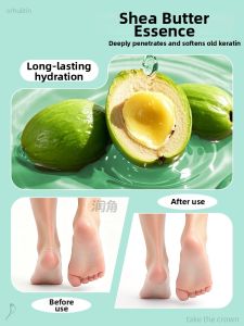 ZHIHAOEN | Moisture Absorbing Deodorizing Anti-Slip Soft Comfortable Insoles