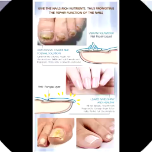 Nail Repair Cream Nail fungus treatment liquid nail care solution 10ml Paronychia Quickly repair damaged nails Herbal formula safe and painless