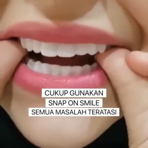 1 Set Atas Bawah Gigi Palsu Dewasa Gigi Snap On Smile Gigi Palsu Atas Bawah Perapi Gigi Veneer Gigi Palsu Atas Bawah Gigi Palsu Snap On Smile Gigi Tiruan