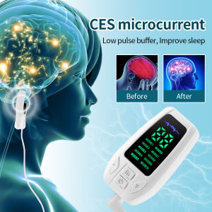 CES Sleep Aid Insomnia Electrotherapy Device Ear Clip 10 Modes Relieve Insomnia Anxiety Sleep Migraine Depression Relieve Instrument