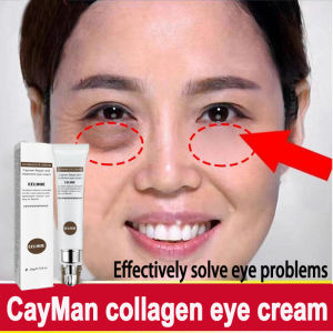 eyebags remover original cream eye cream for wrinkles eyebag remover for men anti aging eye cream for dark under eye anti puffiness Delays Aging Wrinkles Remover Firming Brighten Skin eyecream for eyebags remover eye cream serum panda eye balm cooling 20g