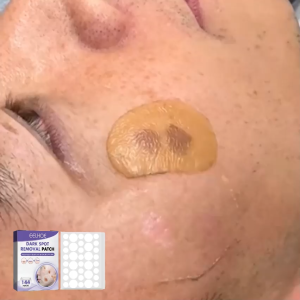 144 miếng dán mụn Hydrocolloid loại bỏ mụn che khuyết điểm che vết thâm miếng dán chăm sóc da mặt