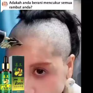 PENUMBUH RAMBUT BOTAK DAN RONTOK DALAM WAKTU 7 HARI PRIA ANAK BAYI CEPAT SERUM ESSENCE Penghitam Uban Penyubur Original