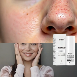 Advanced Blackhead Removal Essence (30ml): For Clear Refined Skin