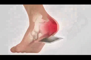 Heel Pain Relief Patch Foot Pain Patch for Fascial Bone-Removing Thorn Inflammation Plantar Fasciitis Relieves Ankle Pain 12pcs/box足跟痛贴