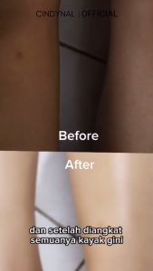 BPOM Cindynal Perontok Bulu Permanen Tidak Tumbuh Lagi Senana Marina Cream Penghilang Bulu Ketiak Tangan Kaki Praktis