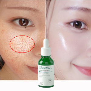 【100% Asli 】Pengecil pori pori wajah Serum pengecil pori pori 30ml Mengurangi pori-pori yang membesar dan memberi nutrisi pada kulit Meremajakan mencerahkan dan menghaluskan kulit Mengisi kembali kelembapan kulit