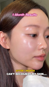 [Free 1 Gift] Combo x4 SEYOUL 21 DAYS SERUM | Melasma Freckles Large pores Adds moisture | Helps the skin become bright and healthy | Suitable for all skin types | Free 1Travel Bottle Set