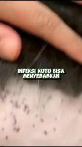 OBAT KUTU UNTUK KUCING Paket Hemat 500ML | Pembasmi Kutu Hewan